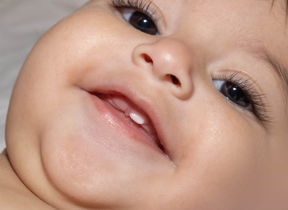 รายละเอียดใบหน้าและปากของทารกที่มีฟันซี่แรกขึ้น ในเหงือกส่วนบนมีฟันใหม่สองซี่เกิดขึ้น กล่าวถึงพัฒนาการของทารก